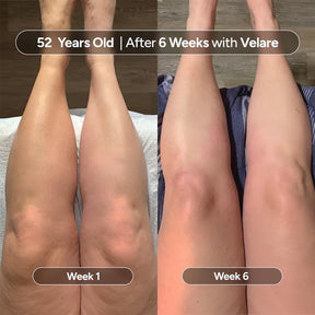 Women's Wellness Anti-Cellulite Massage Oil